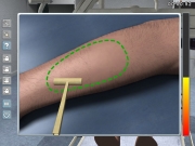 Chirurgie-Simulator 2011 - Screenshot aus der Simulation