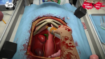 Surgeon Simulator: Anniversary Edition: Screenshots zum Artikel